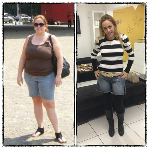 Antes e Depois Cirurgia Bariátrica - 9 meses